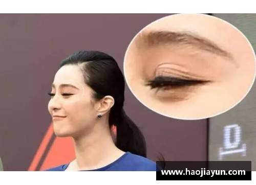 体育明星大小眼如何调整治疗方法介绍